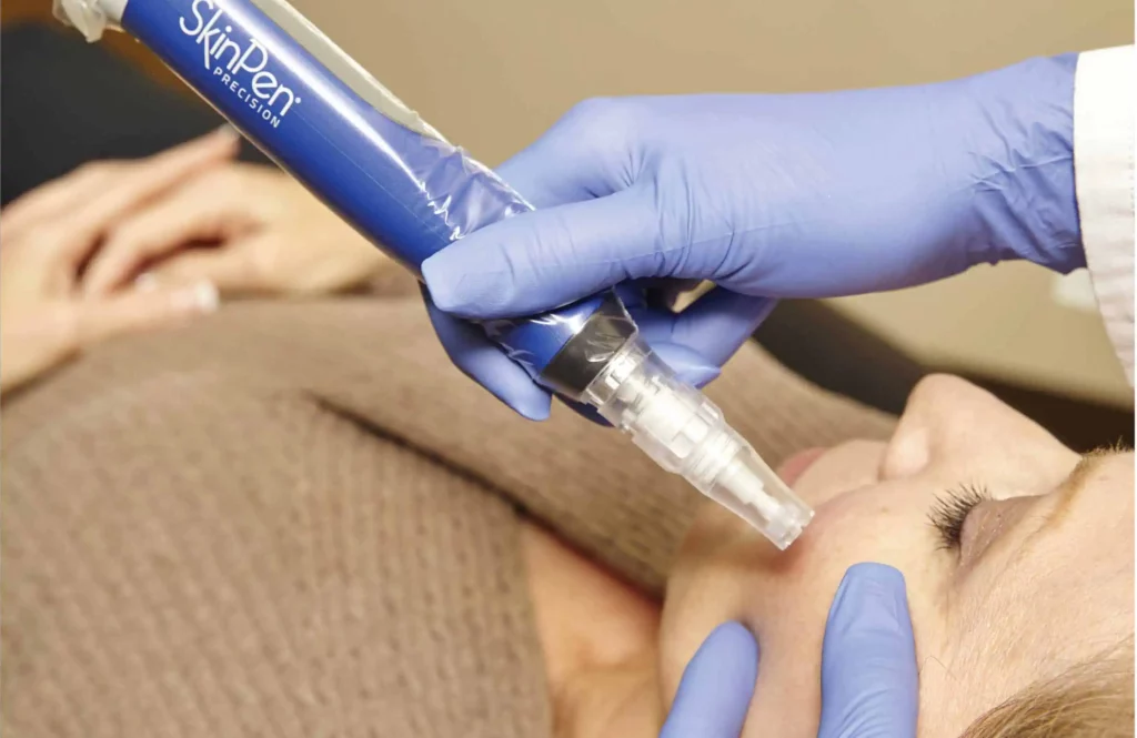 Microneedling Treatment by The Park Medspa in Highland Park, NJ