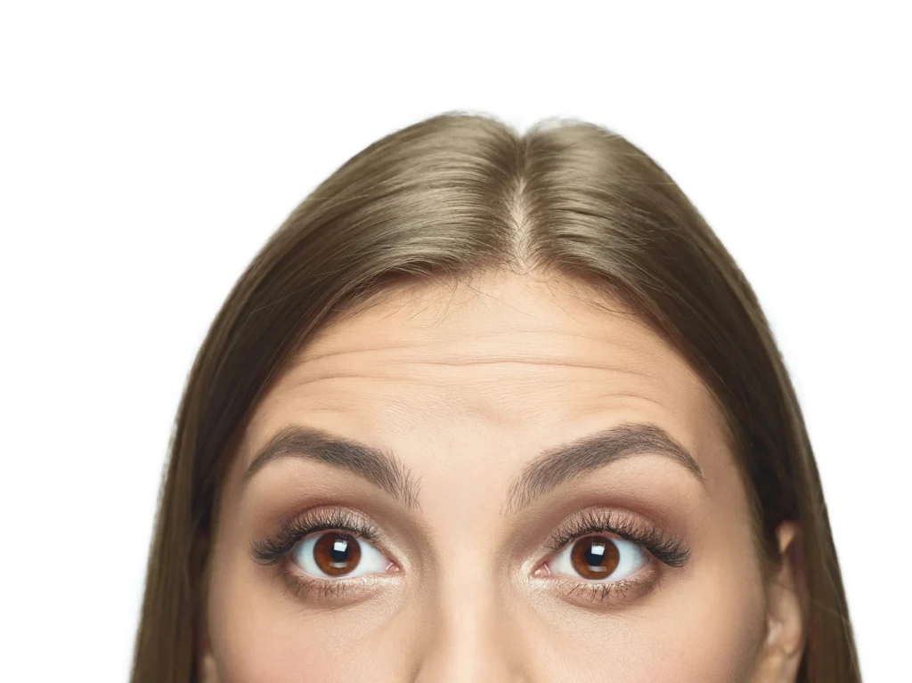 Wrinkles Treatment | Portfolio