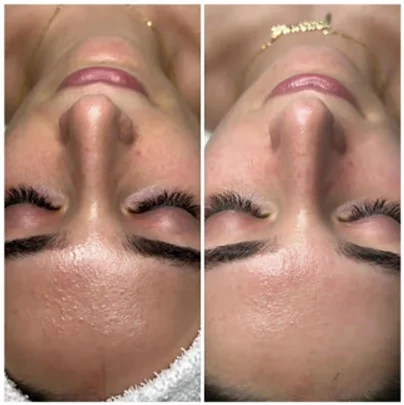 IMPROVE AND MAINTAIN HEALTHY SKIN FOR LONG TERM RESULTS blog thepark medspa in Highland Park NJ | 3 Reasons Why You Should Start Getting Monthly Facials
