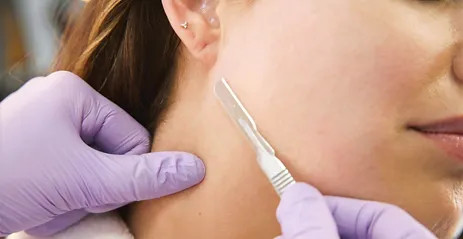 The Magic of Add-On Treatments to Enhance Result 2 the magic dermaplnning blog thepark medspa in Highland Park NJ | The Magic of Add-On Treatments to Enhance Result