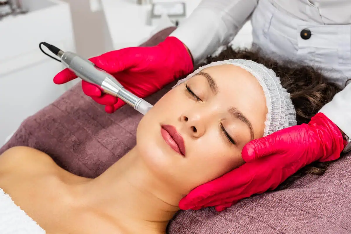 Microneedling treatment by The Park Medspa in Highland Park, NJ