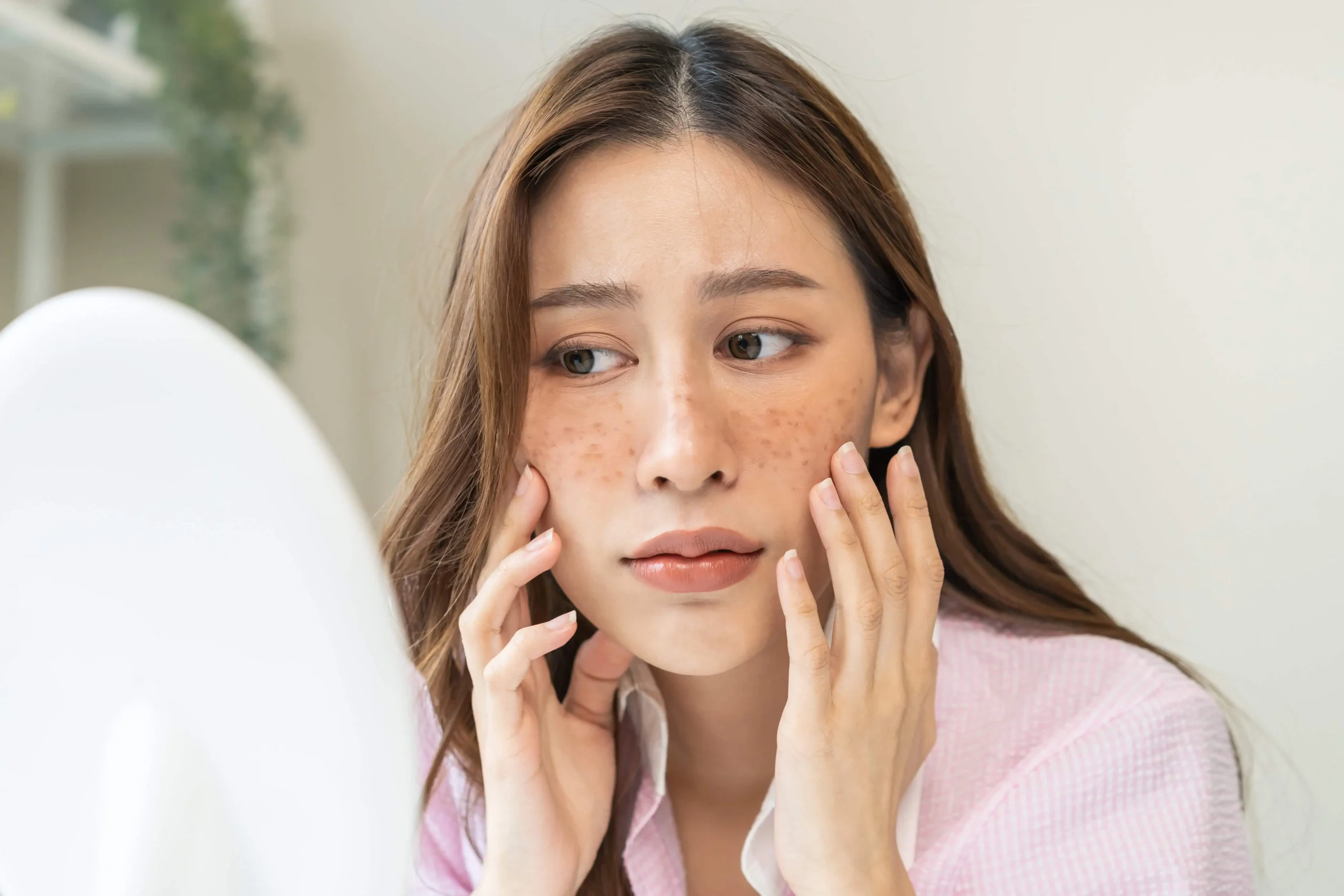 Conditions We Treat 2 Acne Scarring Treatment scaled | Conditions We Treat